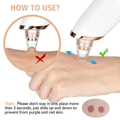 5 in 1 Electric Blackhead Acne Oil Remover Vacuum Suction Face Pore Cleaner Machine
