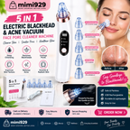 Electric Blackhead Remover
